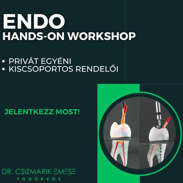 Gépi endodoncia PRIVÁT és CSOPORTOS HANDS-ON WORKSHOP