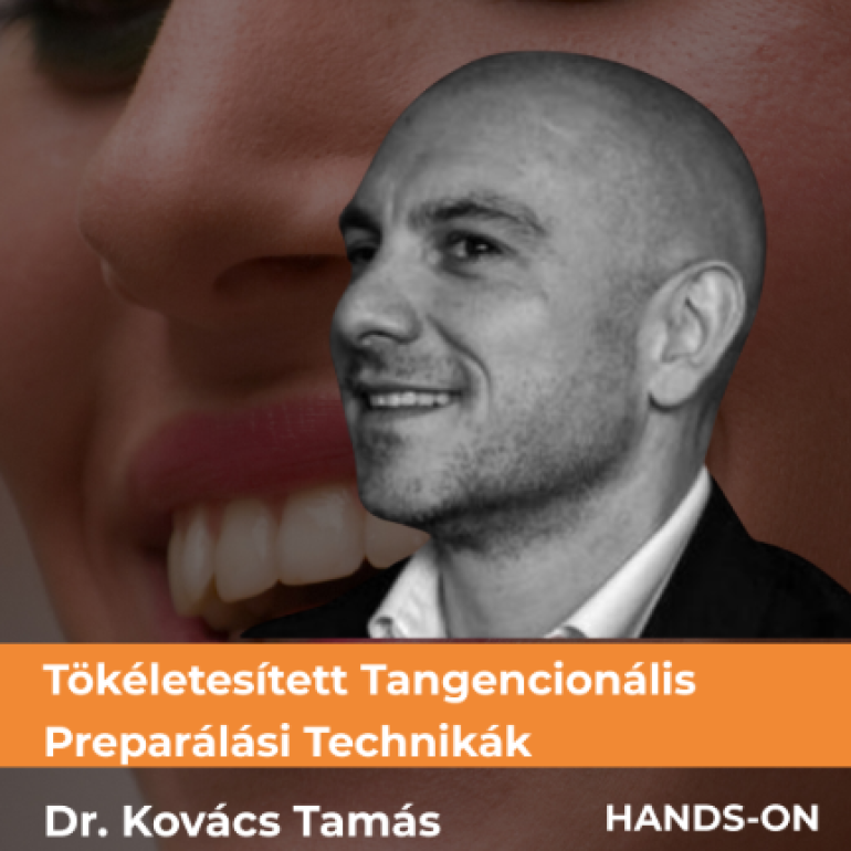 Tökeletesített Tangencionális Preparálási Technikák