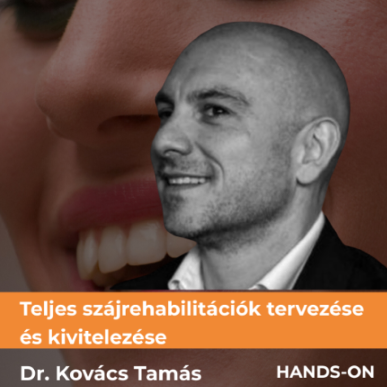 Teljes szájrehabilitációk tervezése és kivitelezése