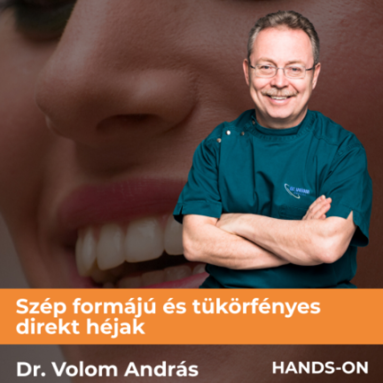 Szép formájú és tükörfényes direkt héjak