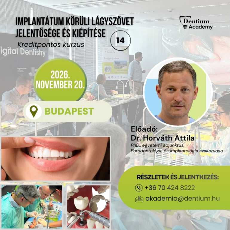 Implantátum körüli lágyszövet jelentősége és kiépítése