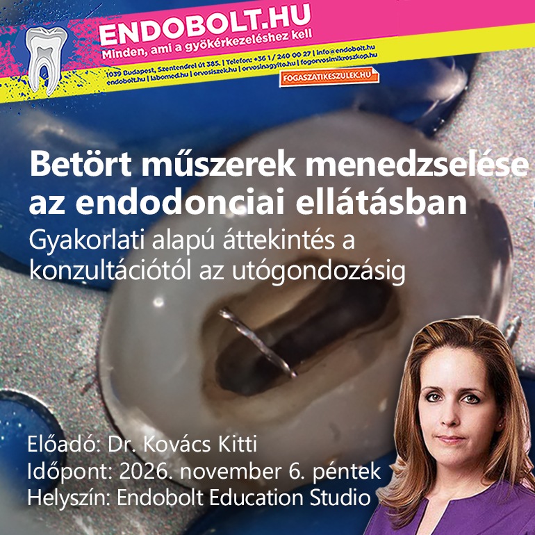 Betört műszerek menedzselése az endodonciai ellátásban
