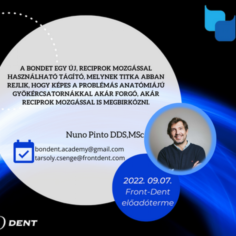 THE SECRET OF THE NEW BONDENT FILE