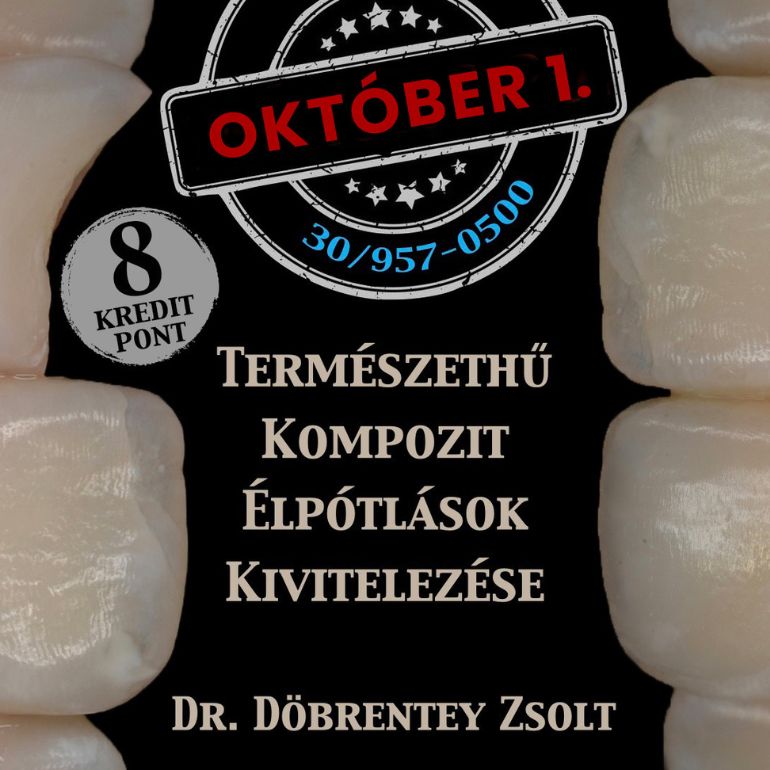 Természethű kompozit élpótlások kivitelezése – Tippek és trükkök a tervezhető siker érdekében