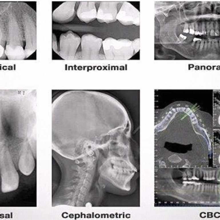 Dental-X – fogászati radiológia workshop