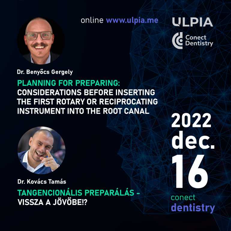 Dr. Kovács Tamás - Tangencionális preparálás - vissza a jövőbe!? - Dr. Benyőcs Gergely - Planning for preparing: considerations before inserting the first rotary or reciprocating instrument into the root canal