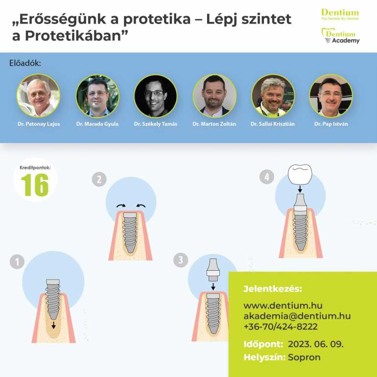 Erősségünk a Protetika - Lépj szintet a protetikában