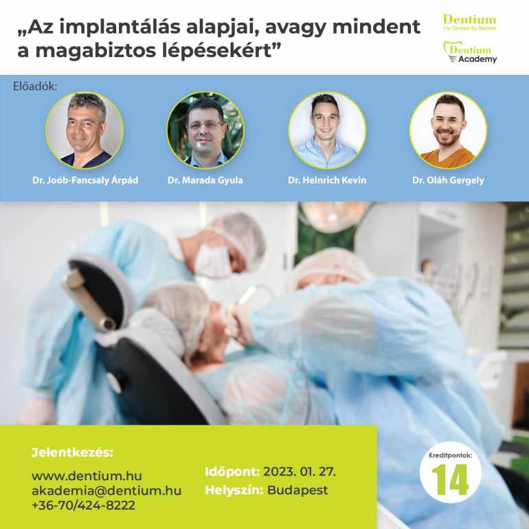 Az implantálás alapjai, avagy mindent a magabiztos lépésekért