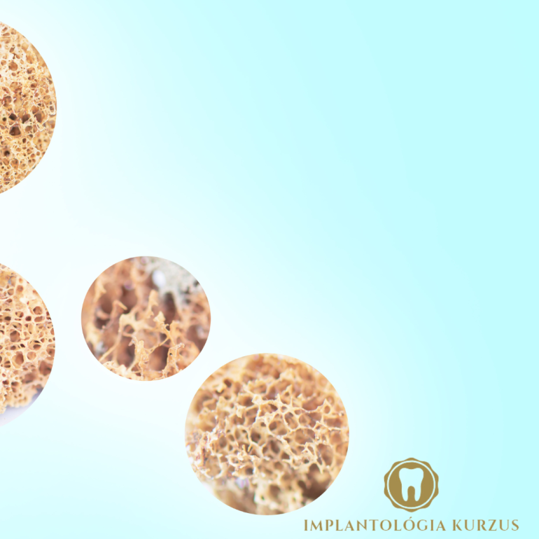 Az alapoktól a mester fokozatig! 10 napos orális implantológiai kurzus. 3. rész