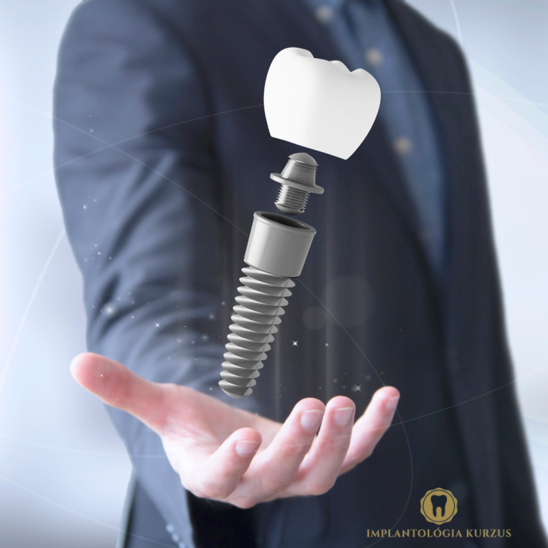 Az alapoktól a mester fokozatig! 10 napos orális implantológiai kurzus. 5. rész