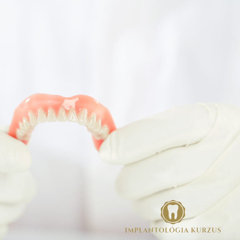 Az alapoktól a mester fokozatig! 10 napos orális implantológiai kurzus. 6. rész