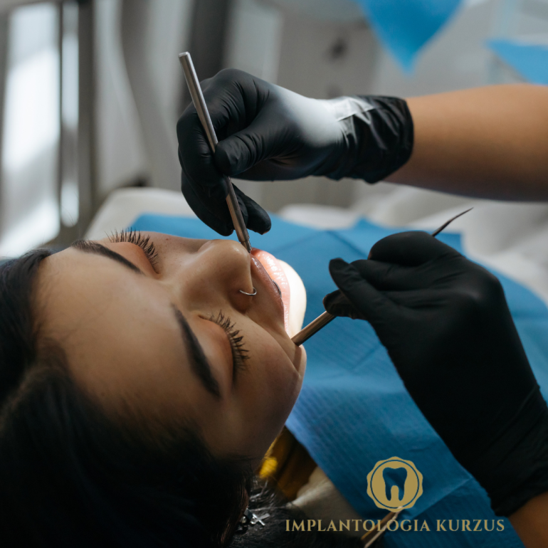 Az alapoktól a mester fokozatig! 10 napos orális implantológiai kurzus. 7. rész