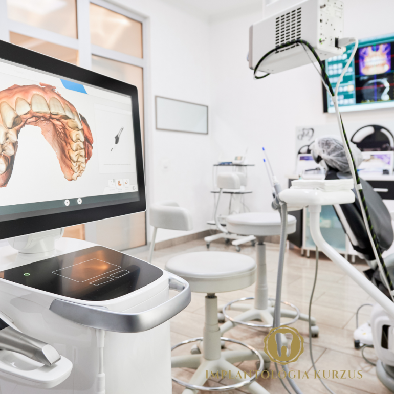 Az alapoktól a mester fokozatig! 10 napos orális implantológiai kurzus. 9. rész