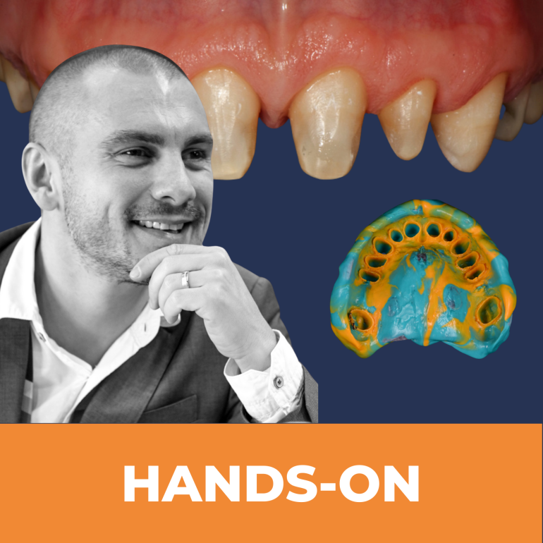 TÖKÉLETESÍTETT TANGENCIONÁLIS PREPARÁLÁSI TECHNIKÁK DR. KOVÁCS TAMÁSSAL (NO.2.)