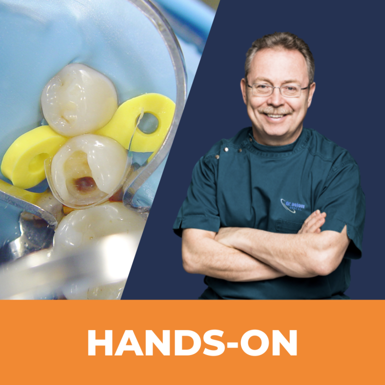 Matrica Hardcore: Szekcionált és Speciális Matricák Használata Nehéz Esetekben (No.3.)