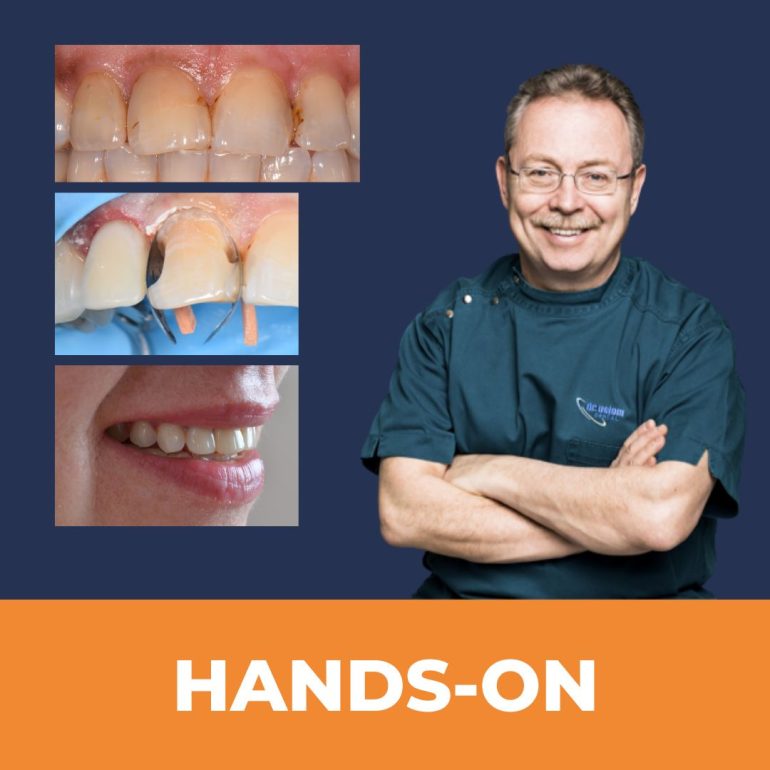 Direkt Héj és IV. Osztály Mesterfokon (No.2.)