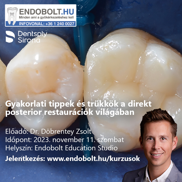 Gyakorlati Tippek és Trükkök a direkt posterior restaurációk világában