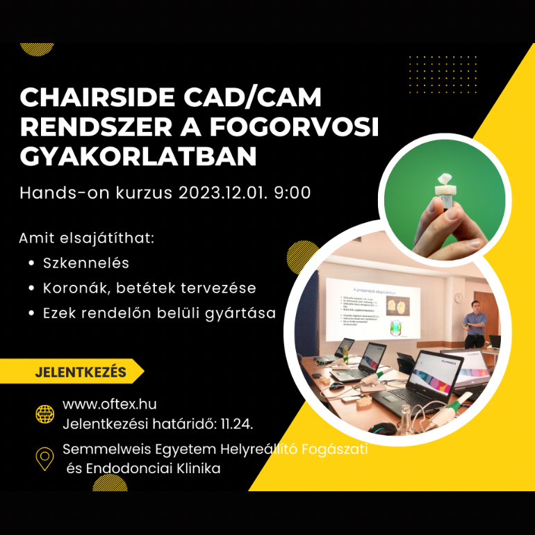 Chairside CAD/CAM rendszer a fogorvosi gyakorlatban