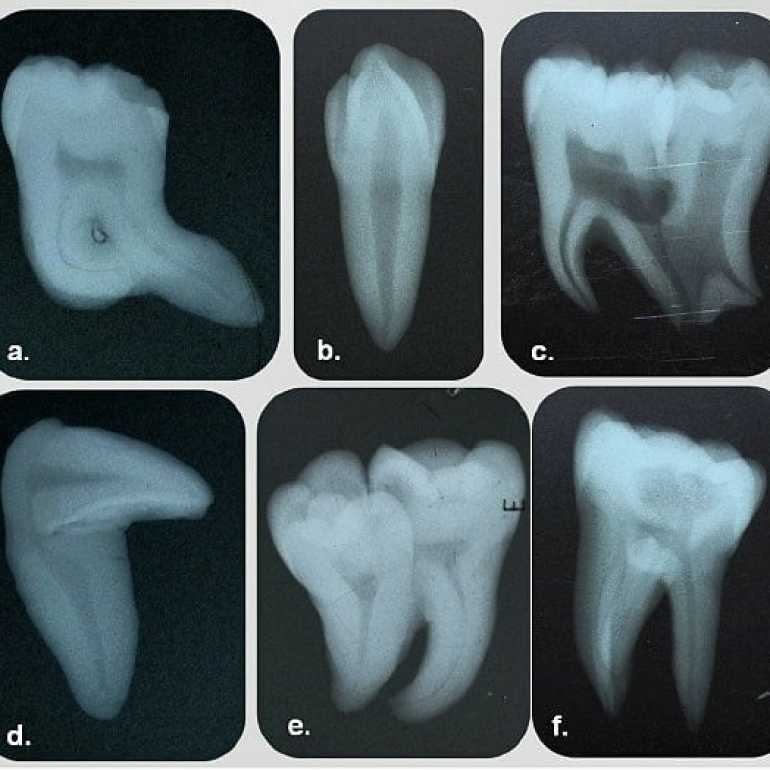 Dental-X – fogászati radiológia workshop