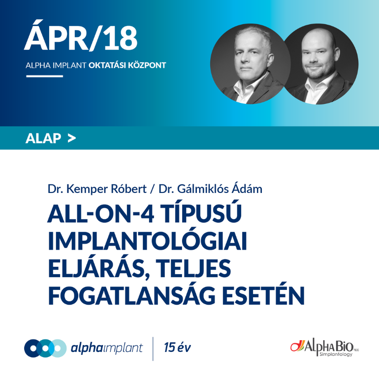All-on 4 típusú implantológiai eljárás, teljes fogatlanság esetén