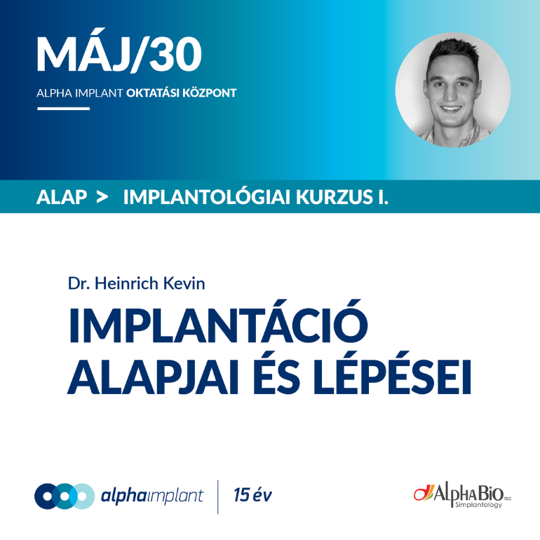 1/3 Implantáció alapjai és lépései | Dr. Heinrich Kevin
