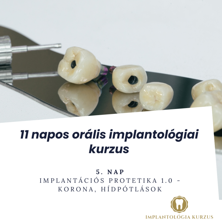 Az alapoktól a mester fokozatig! 11 napos orális implantológiai kurzus. 5. rész