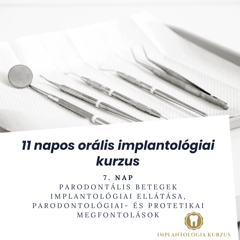 Az alapoktól a mester fokozatig! 11 napos orális implantológiai kurzus. 7. rész
