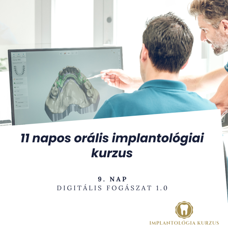 Az alapoktól a mester fokozatig! 11 napos orális implantológiai kurzus. 9. rész