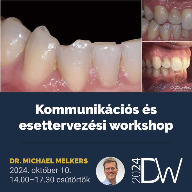 Ahol van egy MIÉRT, ott van egy MEGOLDÁS is! – Kommunikációs és esettervezési workshop