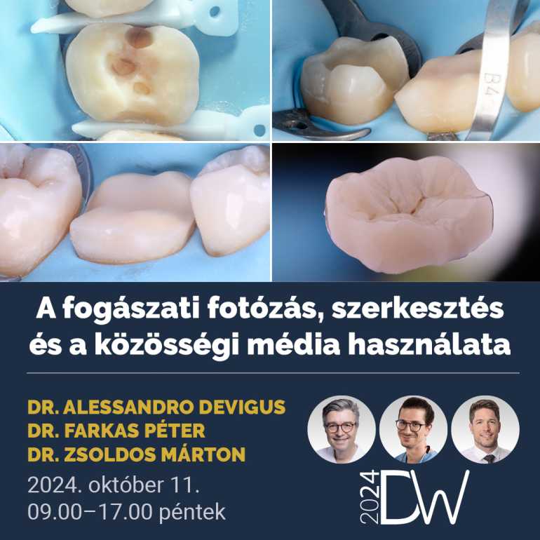 A fogászati fotózás, szerkesztés és a közösségi média használata