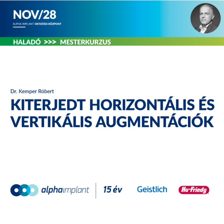 Kiterjedt horizontális és vertikális augmentációk mesterkurzus