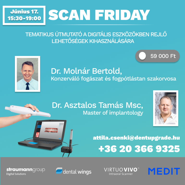 Scan Friday