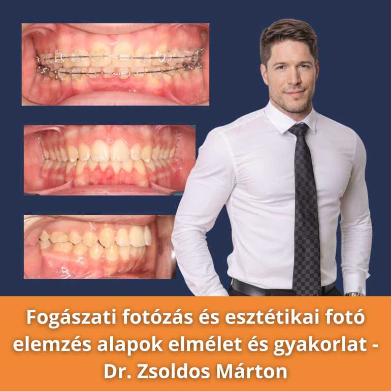 Fogászati fotózás és esztétikai fotó elemzés alapok elmélet és gyakorlat