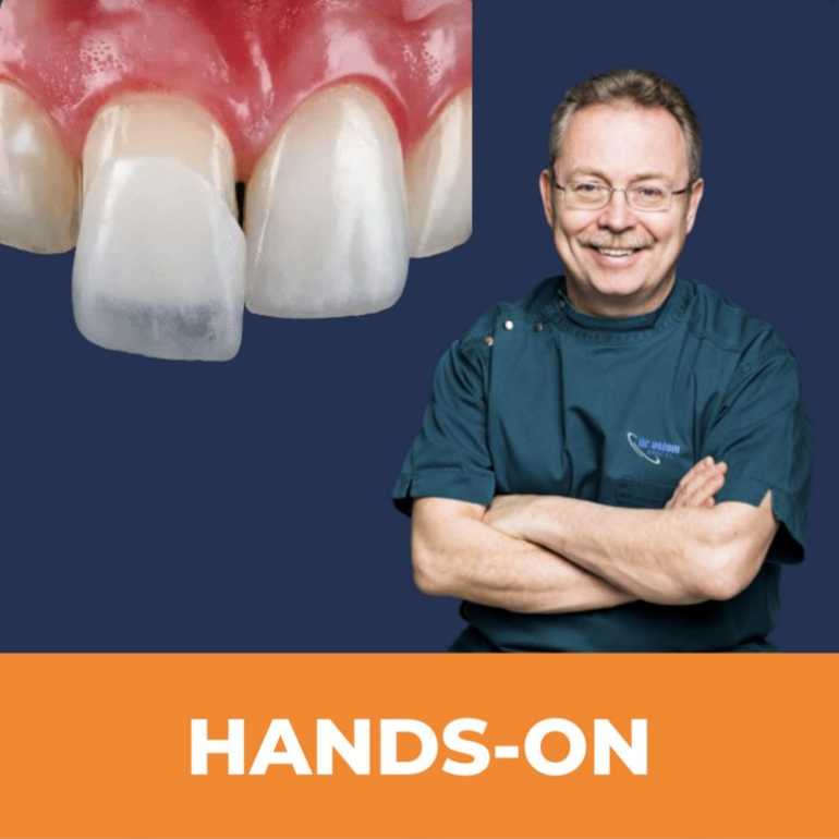 Héjberagasztás és Preparálás