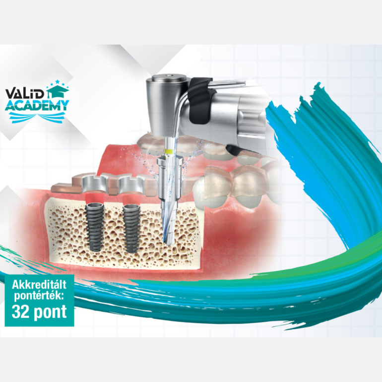 VaLiD-Academy: Digitálisan navigált implantológia