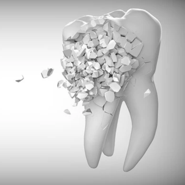 Sürgősségi esetek a fogorvosnál - ONLINE távoktatás