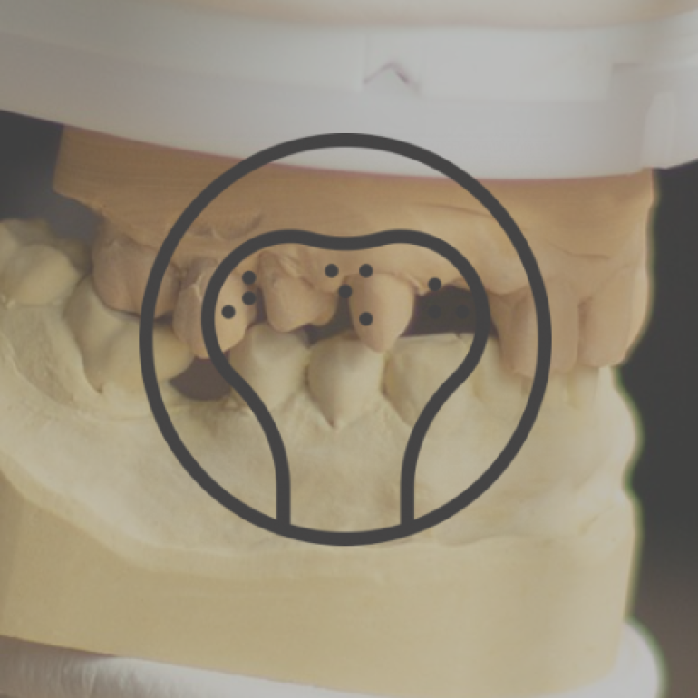 11 napos Implantológiai alapkurzus 4. nap - Csontpótló eljárások - sinus lift