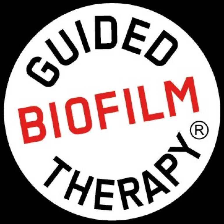 GBT – az alapoktól kezdve