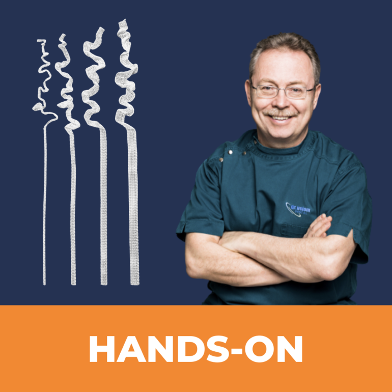 Szálerősítés Ribbonddal Helyesen: A Vészhelyzeti Sínezéstől a Direkt Hidakig