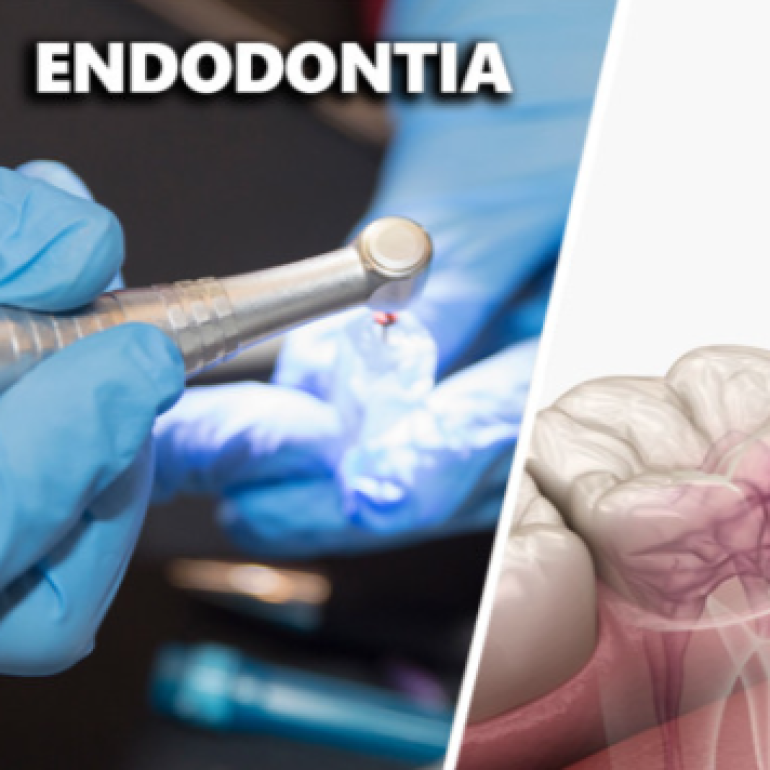 személyre szabott endo konzultáció