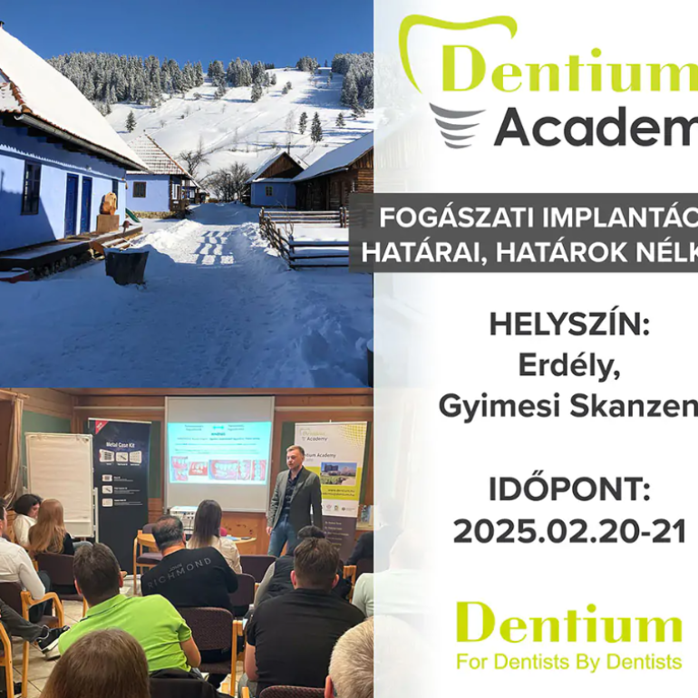 A fogászati implantáció határai – határok nélkül