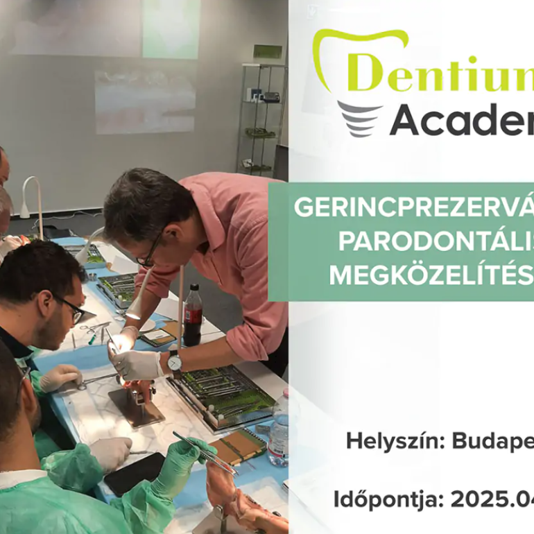 Gerincprezerváció parodontális megközelítései