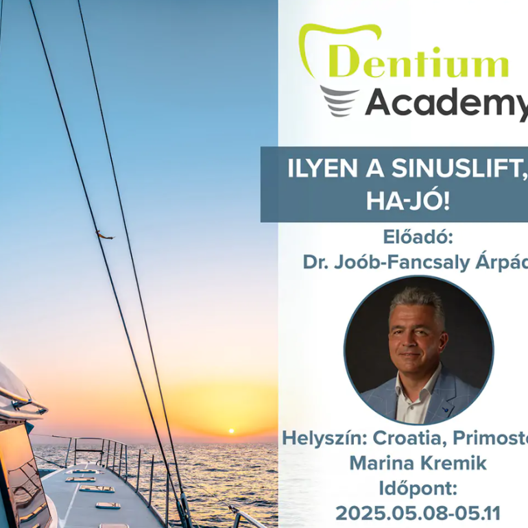 Ilyen a Sinuslift, HA-JÓ!