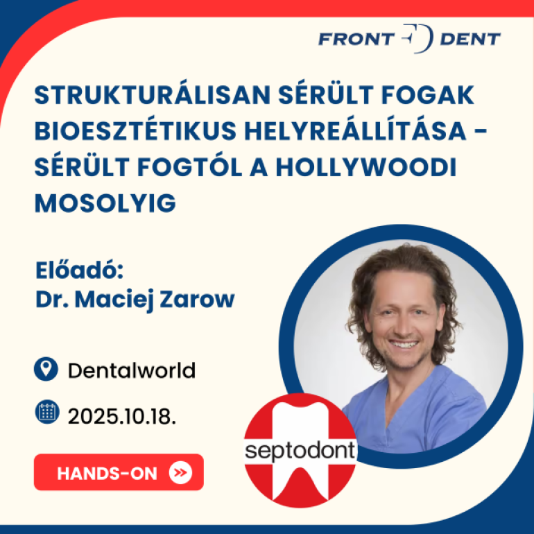 Strukturálisan sérült fogak bioesztétikus helyreállítása - Sérült fogtól a hollywoodi mosolyig