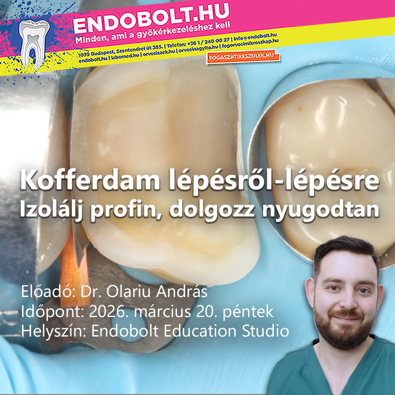 Kofferdam lépésről-lépésre